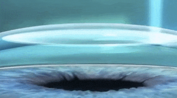 微信图片_20260105101458.gif
